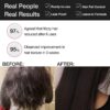 Soulflower Rosemary Water Spray for Hair Growth | Niacinamid... - Image 7
