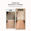 The Plush Co. Ipl Hair Removal Laser Machine For Women&Men|A... - Image 8