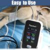 Pepultech 6 Parameters Veterinary Vital Signs Monitor,Blueto... - Image 7