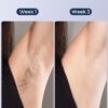 LUBEX Laser Hair Removal for Women and Men, Sapphire Ice-Coo... - Image 6