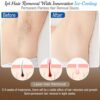 TEAKADO FDA Cleared Laser Hair Removal for Women and Men, IP... - Image 6